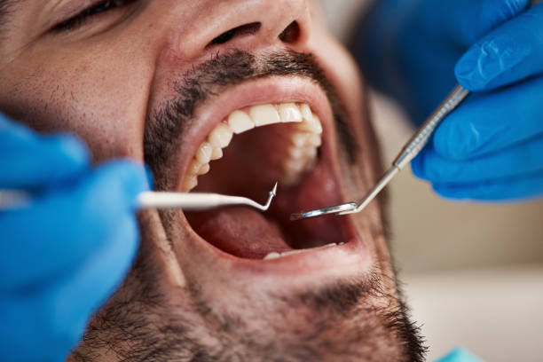 Best Emergency Dental Care for Abscessed Tooth in Westport, WA